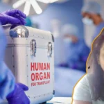 organ transplant